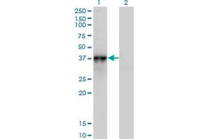 Western Blot analysis of NOV expression in transfected 293T cell line by NOV monoclonal antibody (M01), clone 3C2. (NOV 抗体  (AA 1-357))