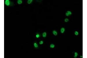 Immunofluorescence (IF) image for anti-Tumor Protein P53 (TP53) antibody (ABIN1499976) (p53 抗体)