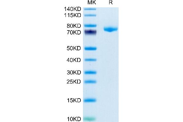 Desmoglein 3 Protein (DSG3) (AA 50-617) (His tag)