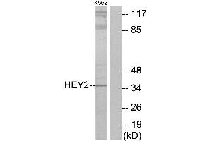 Western blot analysis of extracts from K562 cells, using HEY2 antibody. (HEY2 抗体)