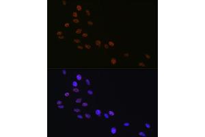 Immunofluorescence analysis of C6 cells using Matrin 3 Rabbit mAb (ABIN7268414) at dilution of 1:100 (40x lens).