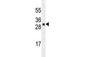 UBTD1 antibody western blot analysis in A549 lysate. (UBTD1 抗体)