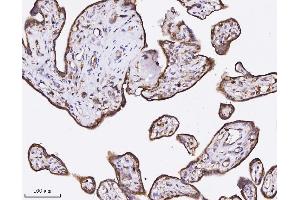 IHC analysis of Annexin A3 using anti-Annexin A3 antibody (ABIN7602989).