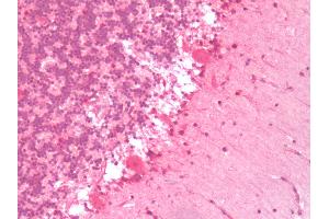 Human Brain, Cerebellum: Formalin-Fixed, Paraffin-Embedded (FFPE) (Serotonin Receptor 6 抗体  (C-Term))