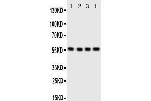Anti-Glucose Transporter 5 GLUT5 antibody, Western blotting Lane 1: U87 Cell Lysate Lane 2: 293T Cell Lysate Lane 3:  Cell Lysate Lane 4: SW620 Cell Lysate (SLC2A5 抗体  (C-Term))