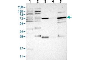 Western blot analysis of Lane 1: RT-4, Lane 2: U-251 MG, Lane 3: Human Plasma, Lane 4: Liver, Lane 5: Tonsil with NUDCD1 polyclonal antibody  at 1:250-1:500 dilution. (NUDCD1 抗体)