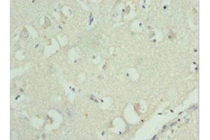 Immunohistochemistry of paraffin-embedded human brain tissue using ABIN7142845 at dilution of 1:100 (RPL9 抗体  (AA 1-192))