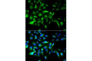 Immunofluorescence analysis of HeLa cell using MYD88 antibody. (MYD88 抗体  (AA 60-309))