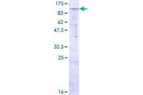 ZNF585B Protein (AA 1-769) (GST tag)