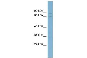 WB Suggested Anti-RPA1  Antibody Titration: 0. (RPA1 抗体  (Middle Region))