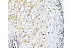 Immunohistochemistry of paraffin-embedded Human esophagus using NMU Polyclonal Antibody at dilution of 1:100 (40x lens). (Neuromedin U 抗体)