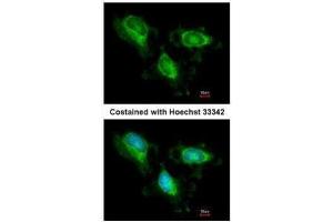 ICC/IF Image Immunofluorescence analysis of methanol-fixed HeLa, using Fumarate hydratase, antibody at 1:200 dilution. (FH 抗体)