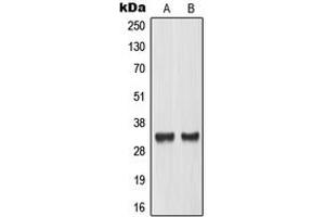 Western blot analysis of TCFL4 expression in LOVO (A), mouse placenta (B) whole cell lysates.