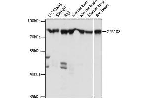 Western blot analysis of extracts of various cell lines, using GPR108 antibody (ABIN7267291) at 1:1000 dilution. (GPR108 抗体  (AA 33-260))