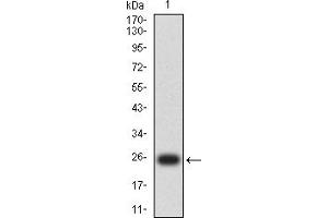 Western blot analysis using MLH1 mAb against human MLH1 (AA: 381-483) recombinant protein. (MLH1 抗体  (AA 381-483))