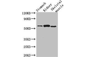 Western Blot Positive WB detected in: Mouse stomach tissue, Mouse kidney tissue, Mouse skeletal muscle tissue All lanes: PPM1H antibody at 3. (PPM1H 抗体  (AA 73-289))