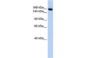 WB Suggested Anti-WDR66 Antibody Titration: 0. (WDR66 抗体  (N-Term))