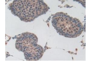 Detection of Plg in Rat Testis Tissue using Polyclonal Antibody to Plasminogen (Plg) (PLG 抗体  (AA 191-433))