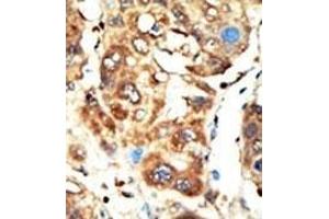 Immunohistochemistry (Paraffin-embedded Sections) (IHC (p)) image for anti-Membrane Associated Guanylate Kinase, WW and PDZ Domain Containing 1 (MAGI1) (AA 1227-1256), (C-Term) antibody (ABIN392808)