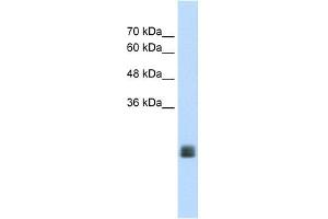 MGC33926 antibody used at 1. (TMEM178 抗体  (Middle Region))