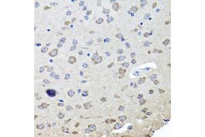 Immunohistochemistry of paraffin-embedded mouse brain using CHRNB2 antibody at dilution of 1:100 (x40 lens). (CHRNB2 抗体)