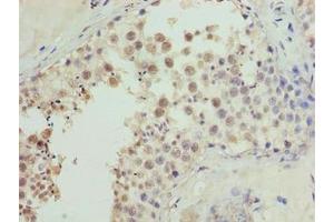 Immunohistochemistry of paraffin-embedded human testis tissue using ABIN7149078 at dilution of 1:100 (CDADC1 抗体  (AA 1-99))