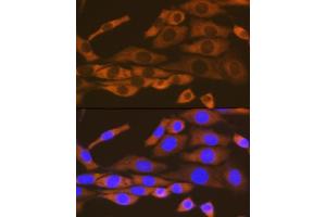 Immunofluorescence (IF) image for anti-Lysyl-tRNA Synthetase (KARS) antibody (ABIN7268350)