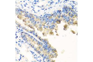 Immunohistochemistry of paraffin-embedded mouse lung using NYX antibody at dilution of 1:100 (40x lens). (Nyctalopin 抗体)