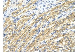 Rabbit Anti-MBNL1 Antibody       Paraffin Embedded Tissue:  Human cardiac cell   Cellular Data:  Epithelial cells of renal tubule  Antibody Concentration:   4. (MBNL1 抗体  (Middle Region))