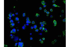 Immunofluorescence staining of 293 cells with ABIN7171036 at 1:100, counter-stained with DAPI. (SUSD5 抗体  (AA 46-287))