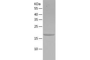 NXT1 Protein (AA 1-160) (His tag)