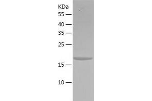 NXT1 Protein (AA 1-160) (His tag)