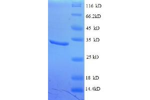 SDS-PAGE (SDS) image for Chromodomain Helicase DNA Binding Protein 4 (CHD4) (AA 1-219), (partial) protein (His tag) (ABIN4976290) (CHD4 Protein (AA 1-219, partial) (His tag))