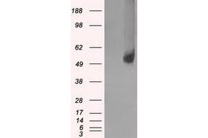 Image no. 2 for anti-Solute Carrier Family 2 (Facilitated Glucose/fructose Transporter), Member 5 (SLC2A5) antibody (ABIN1498472)