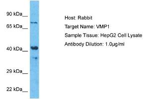 Host:  Rabbit  Target Name:  VMP1  Sample Type:  HepG2 Whole Cell lysates  Antibody Dilution:  1.
