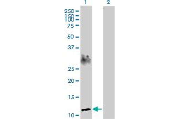 SPEG anticorps  (AA 1-113)