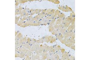 Immunohistochemistry of paraffin-embedded rat heart using PPA1 Antibody. (Pyrophosphatase (Inorganic) 1 (PPA1) (AA 1-289) 抗体)