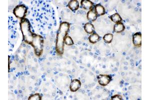 CASR was detected in paraffin-embedded sections of mouse kidney tissues using rabbit anti- CASR Antigen Affinity purified polyclonal antibody (Catalog # ) at 1 ? (CASR 抗体  (AA 926-1078))