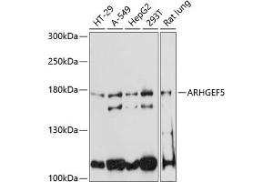 Western blot analysis of extracts of various cell lines, using  antibody (ABIN6129195, ABIN6137096, ABIN6137097 and ABIN6220538) at 1:3000 dilution. (ARHGEF5 抗体  (AA 1248-1597))