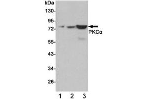 Western blot testing of 1) human C2C12, 2) monkey COS7 and 3) rat C6 cell lysates using PKC alpha antibody at 1:1000. (PKC alpha 抗体)