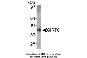 Image no. 1 for anti-Sirtuin 6 (SIRT6) (AA 250-350), (Internal Region) antibody (ABIN363527) (SIRT6 抗体  (Internal Region))