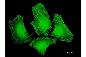 Immunofluorescence of monoclonal antibody to FERMT2 on HeLa cell. (FERMT2 抗体  (AA 1-680))
