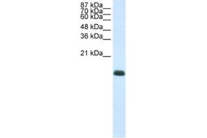 Western Blotting (WB) image for anti-Zinc Finger Protein 786 (ZNF786) antibody (ABIN2461987) (ZNF786 抗体)