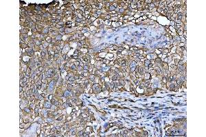 IHC analysis of EPLIN/LIMA1 using anti-EPLIN/LIMA1 antibody (ABIN7602639). (LIMA1 抗体  (AA 9-744))