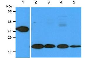 The recombinant human GSTT1 (50ng) and Cell lysates (40ug) were resolved by SDS-PAGE, transferred to PVDF membrane and probed with anti-human GSTT1 antibody (1:1000). (GSTT1 抗体)
