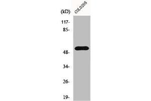 Western Blot analysis of COLO205 cells using HisRS Polyclonal Antibody (HARS1/Jo-1 抗体  (C-Term))
