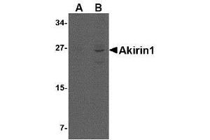 Western blot analysis of Akirin1 in rat liver lysate with AP30039PU-N Akirin1 antibody at (A) 1 and (B) 2 μg/ml. (Akirin 1 抗体  (Center))