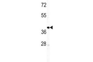 Western blot analysis of IGHM antibody and T47D lysate. (IGHM 抗体  (AA 103-131))