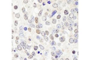 Immunohistochemistry (IHC) image for anti-Histone Deacetylase 7 (HDAC7) (AA 902-952) antibody (ABIN7448594)