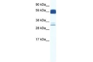 ZIC5 antibody used at 0. (ZIC5 抗体  (N-Term))